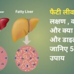 Fatty Liver : क्या है लक्षण व कारण ,उपाय जानिए 5 बेस्ट उपाय