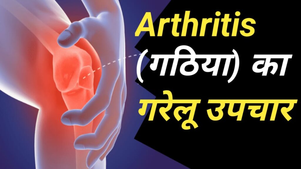 Arthritis